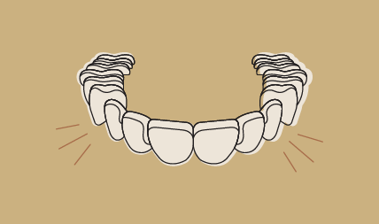 Clear aligners ready for a comfortable, confident smile transformation.