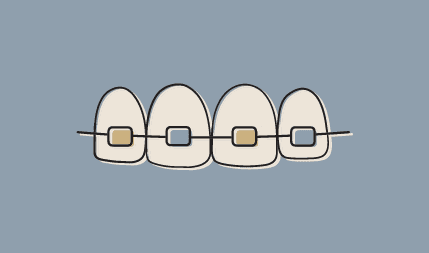 dr-wax-orthodontics-dr-wax-orthoontics-braces-for-kids-adults-teens